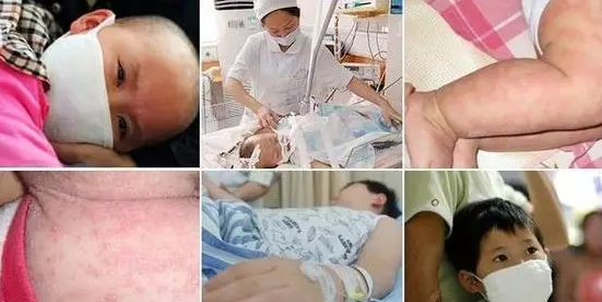 图片 https://www.pregood.com/uploadfile/202103/c1c1f3002d966d4.png